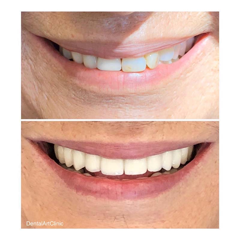 Gallery Οδοντιατρική κλινική Dental Art Clinic