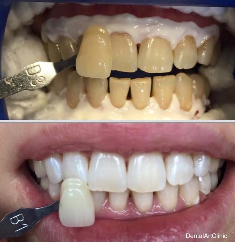 Gallery Οδοντιατρική κλινική Dental Art Clinic